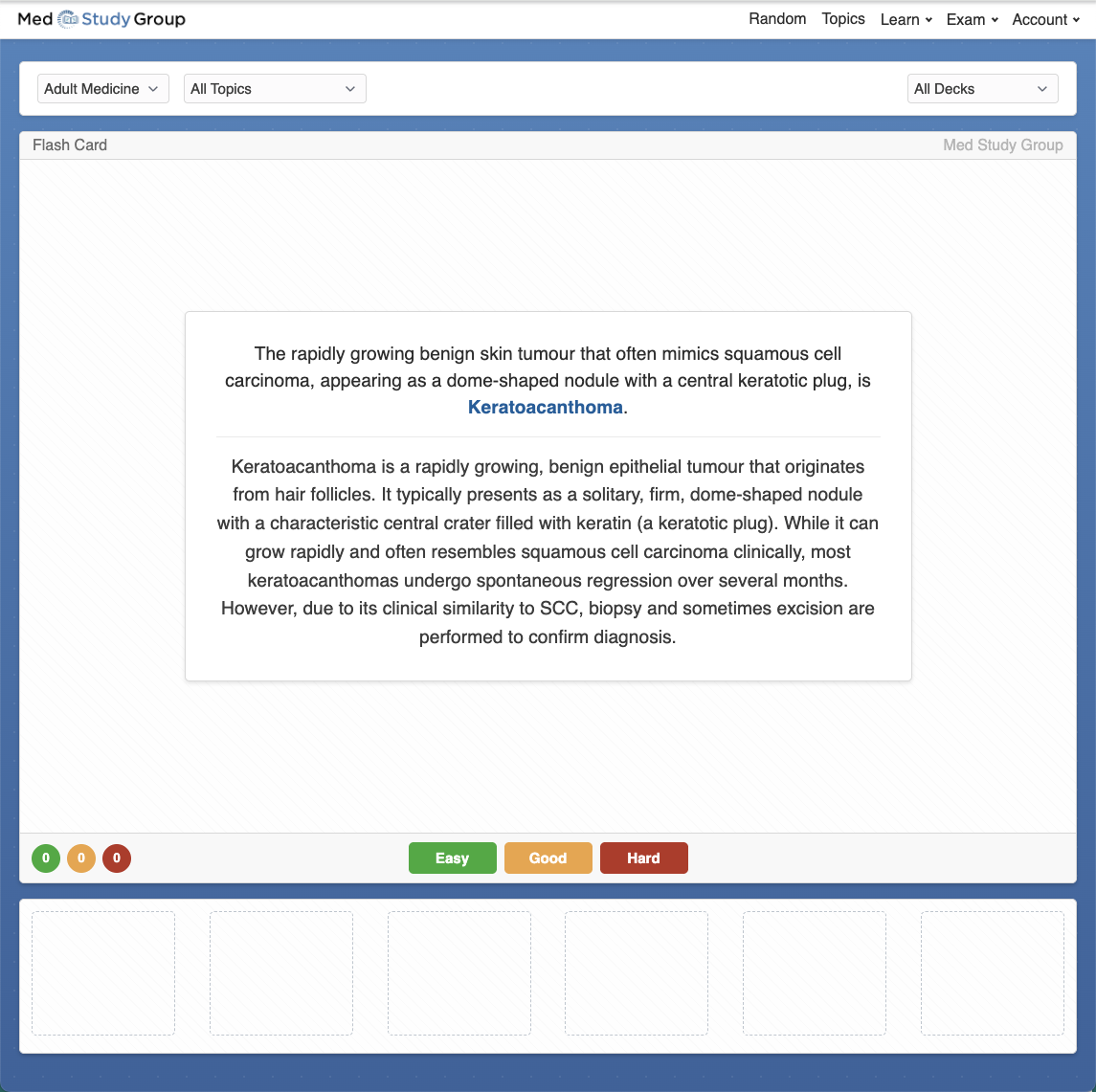Flashcards with spaced repetition