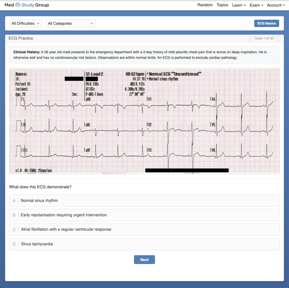 ECG Practice